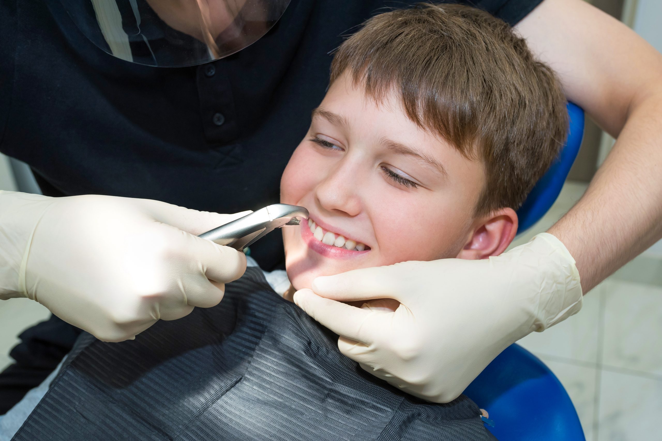 Warrington Tooth Extractions